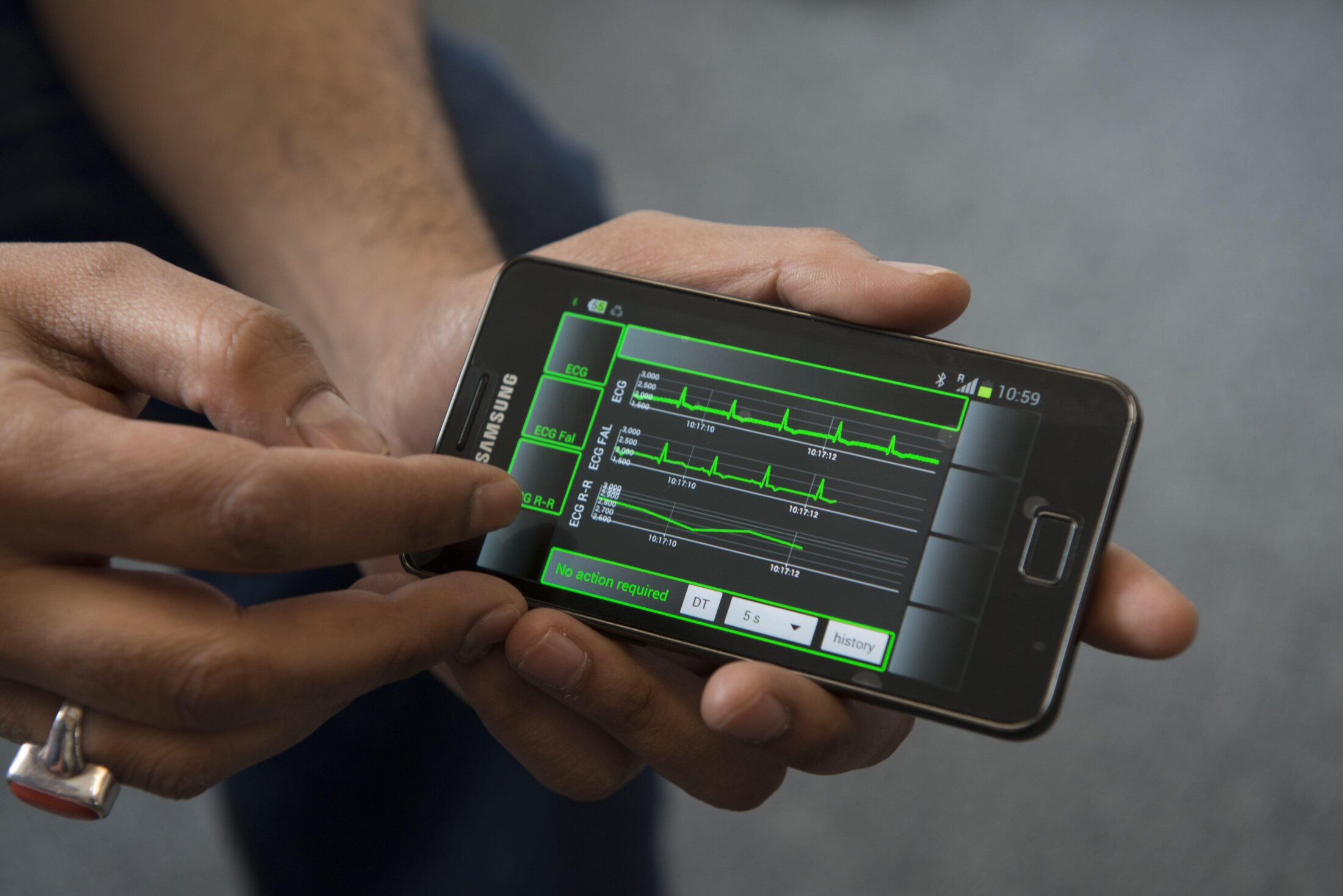 Reviewing health monitoring data on a mobile phone